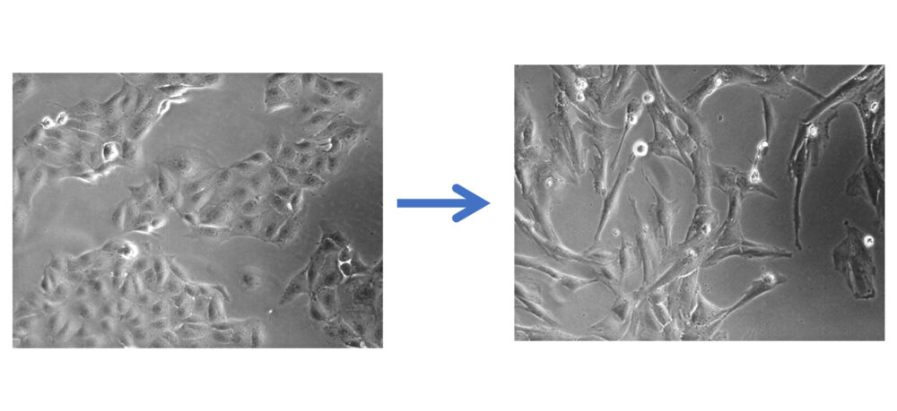 細胞をうつした画像2枚
左は、稲の穂がつらなっているようなもの。右はそこから細長く変化し、オタマジャクシが細いかたちのものが多くある様子